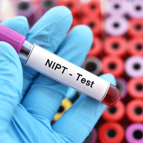 בדיקת nipt מה זה