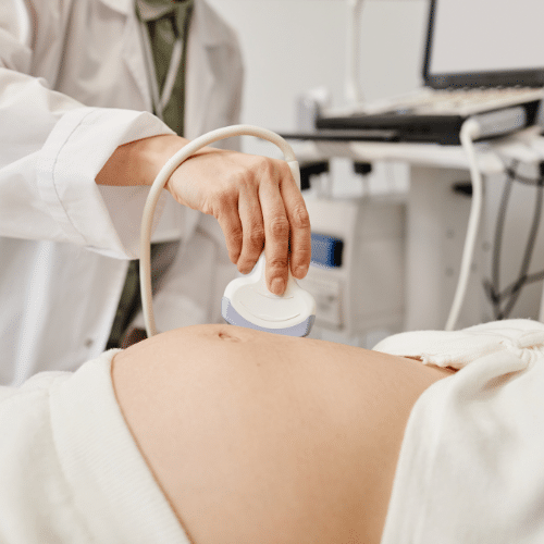 סקירת מערכות מוקדמת